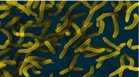 微生物菌劑好？好在哪里您知道嗎？